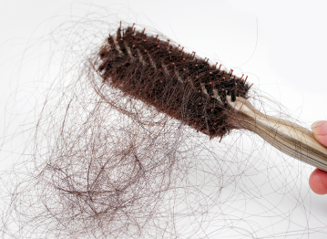 Queda de cabelo